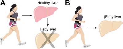 Which Exercise Is Good for Fatty Liver?