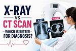 Which Is Better a Ct Scan or Mri?