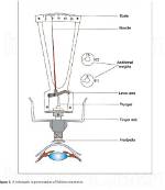 Which Is Indentation Tonometer?
