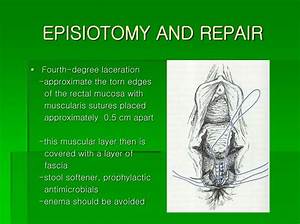 Which Is Worse Episiotomy or Tear?