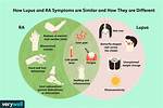 Which Is Worse Ra or Lupus?