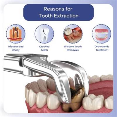 Which Tooth Is Easiest to Extract?