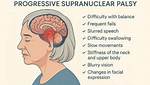 Who Has Progressive Supranuclear Palsy?