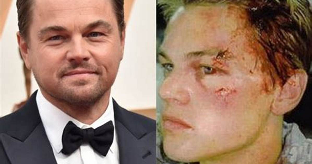 Who Is Aretha Wilson and Where Is Leonardo Dicaprio Attacker Today?