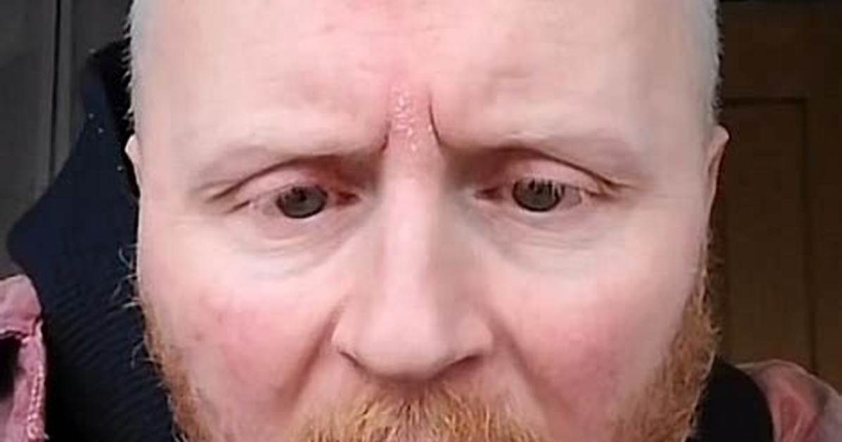 Who Is Paul Breach Aka Beautybeyondthe Eye on Tiktok All We Know About The