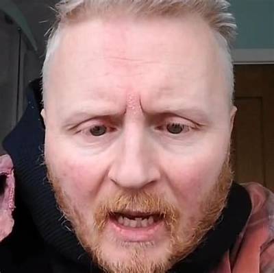 Who Is Paul Breach Aka Beautybeyondthe_Eye on Tiktok? All We Know About the Tiktok Star