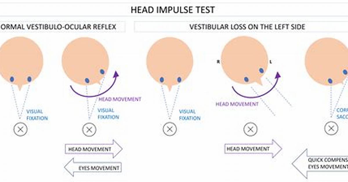 Who Performs Vestibular Testing?