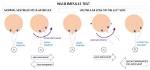 Who Performs Vestibular Testing?