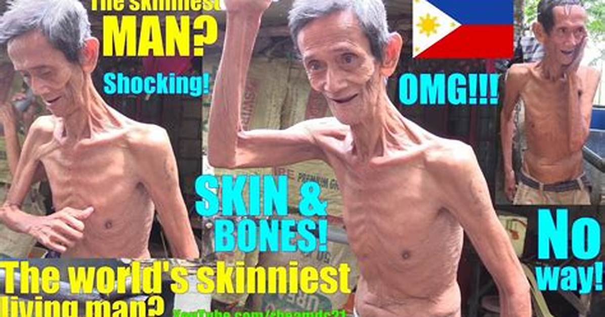 Who's the World's Skinniest Man? Discover the Remarkable Story