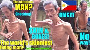 Who's the World's Skinniest Man? Discover the Remarkable Story