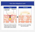Who Should Use Adapalene?