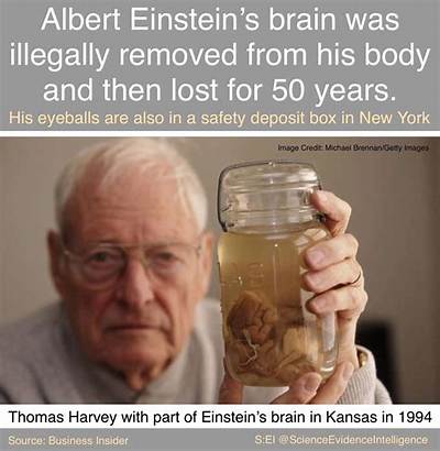 Who Took Alberts Brain?