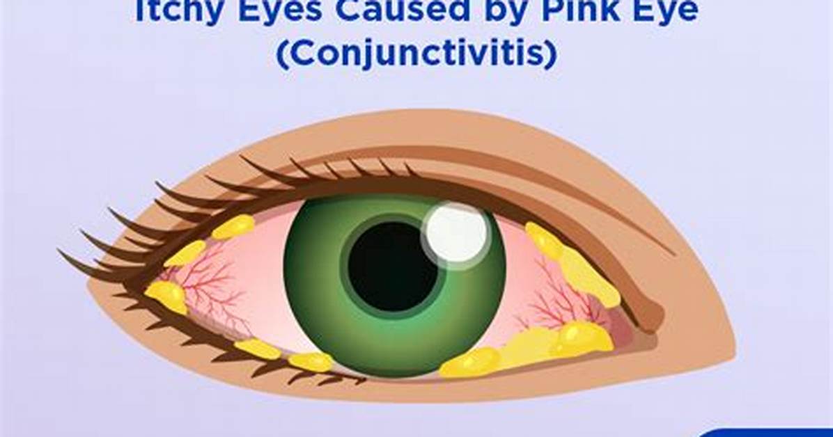 Why Are My Eyes Itchy?