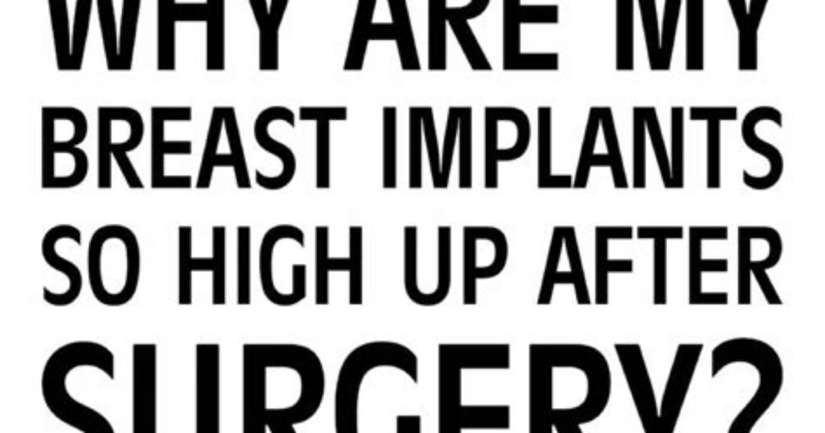 Why Are My Implants So High?