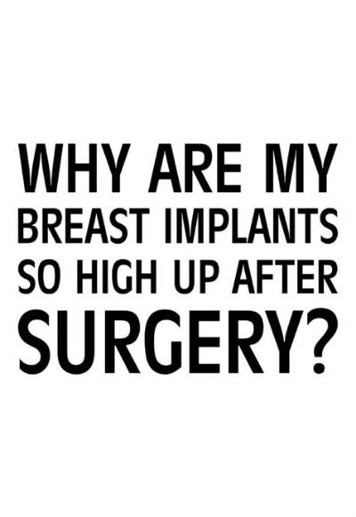 Why Are My Implants So High?