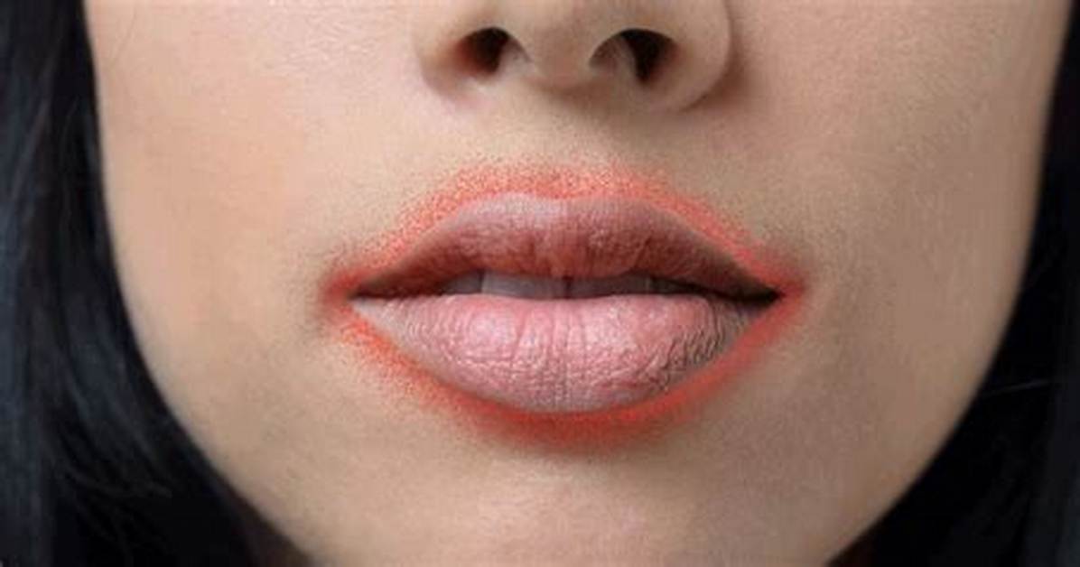 Why Are My Lips Red Around the Edges?