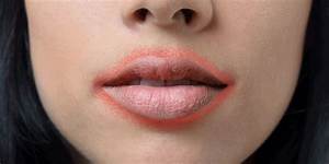Why Are My Lips Red Around the Edges?