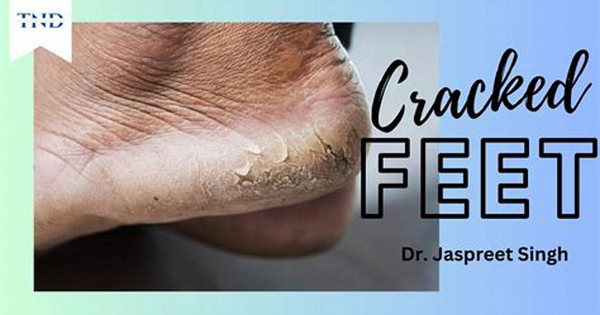 Why Can I Crack My Toes Constantly?