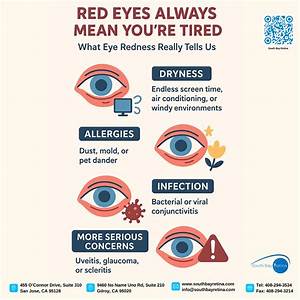 Why Do Eyes Become Red?