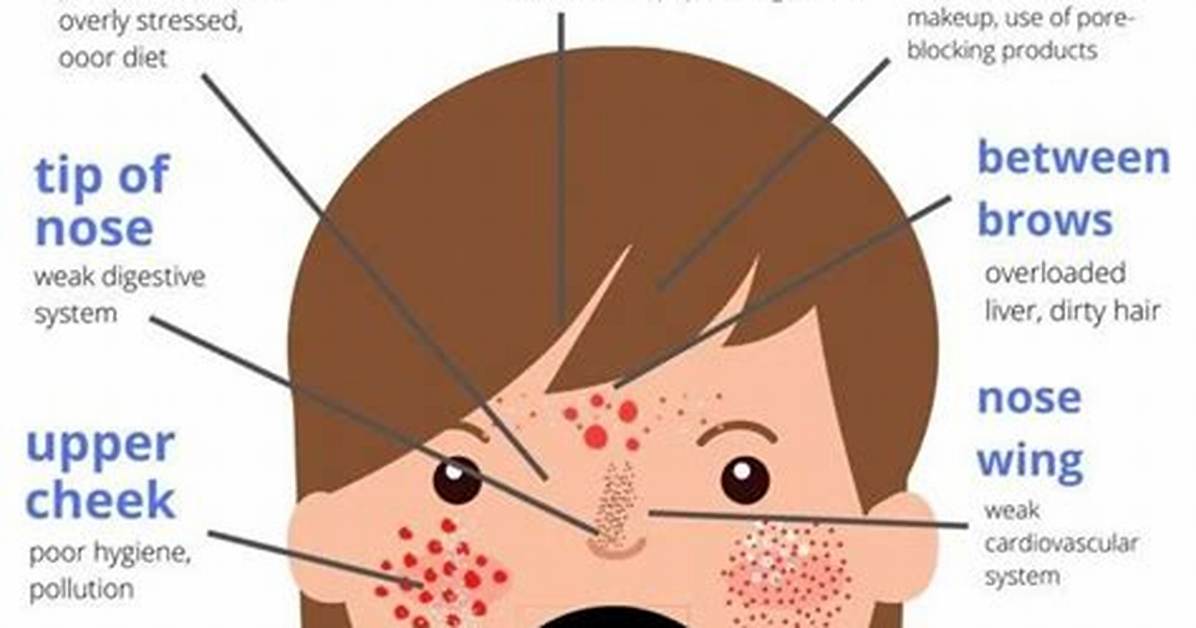 Why Do I Have Pimples on My Legs?