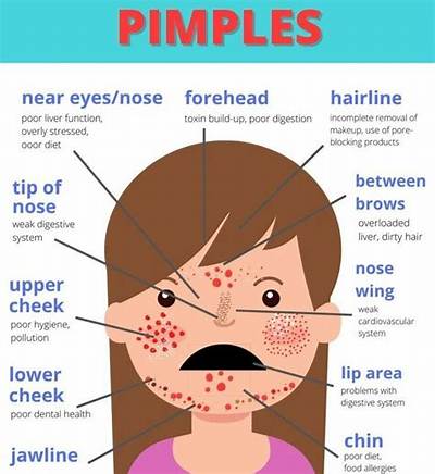 Why Do I Have Pimples on My Legs?