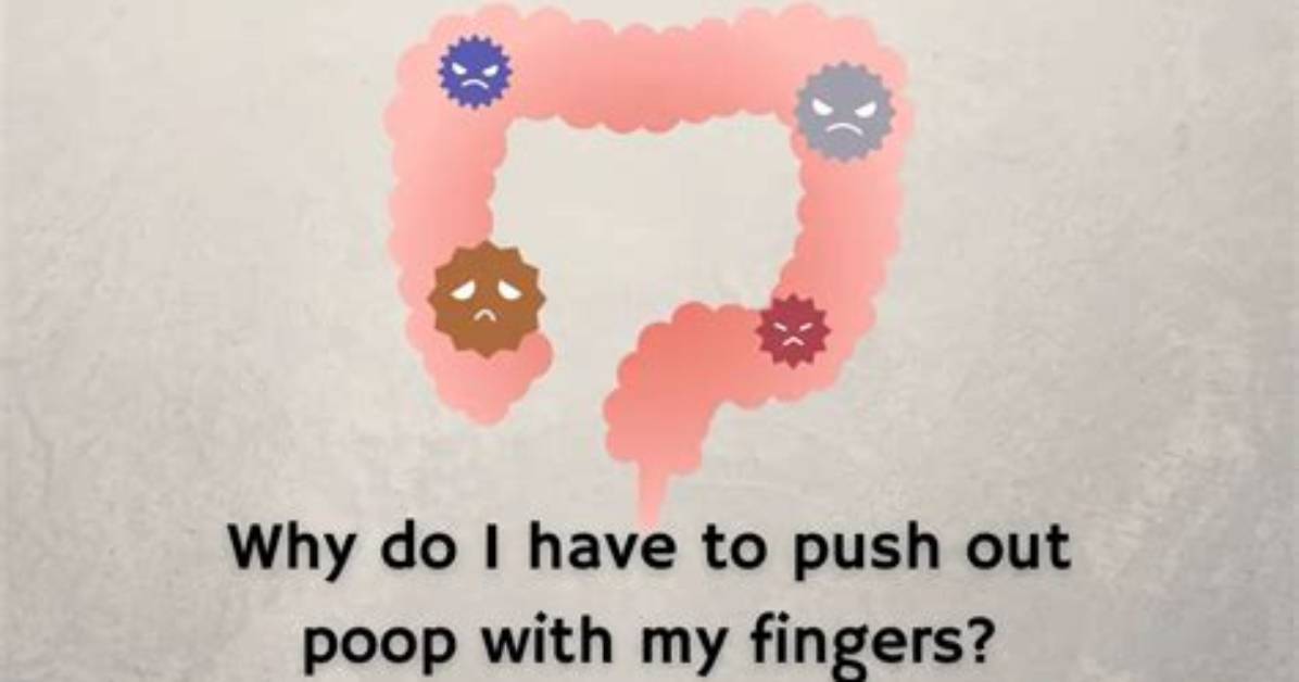 Why Do I Have to Push My Poop out with My Fingers?