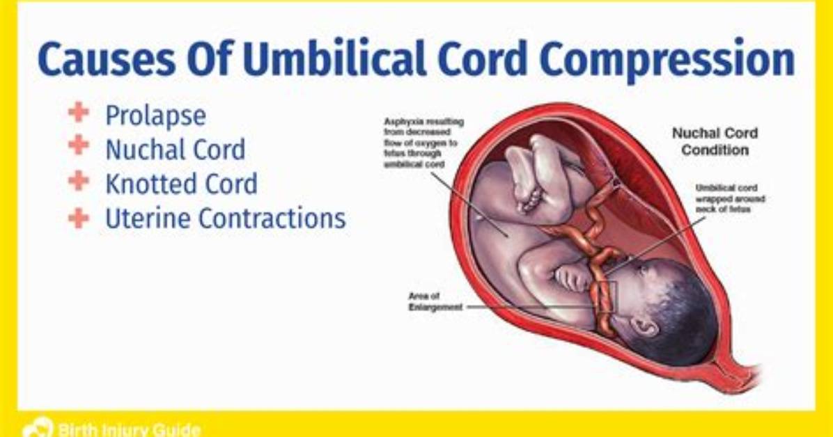 Why Do Japanese Keep Umbilical Cords?