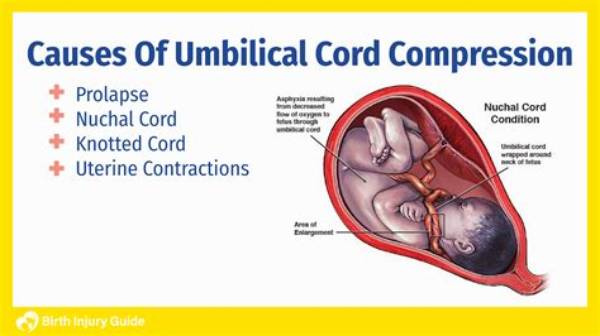 Why Do Japanese Keep Umbilical Cords?