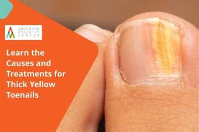 Why Do Toenails Get Thick and Yellow?