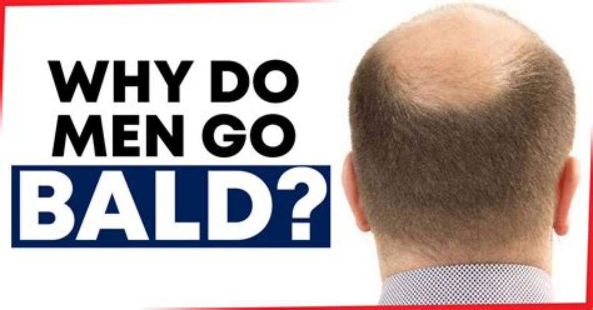 Why Do We Get Bald When Someone Dies?