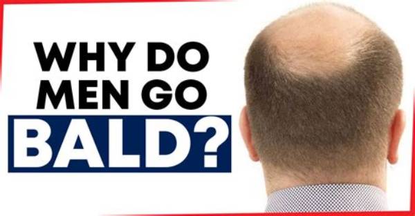 Why Do We Get Bald When Someone Dies?