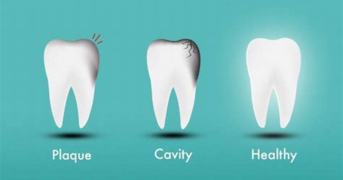 Why Does a Broken Tooth Smell?
