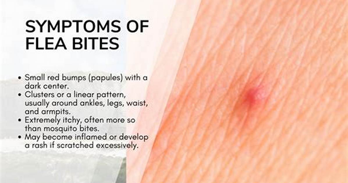 Why Does a Flea Bite Hurt?