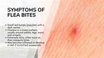 Why Does a Flea Bite Hurt?