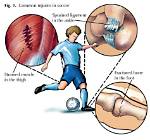 Why Does an Injury Hurt More the Next Day?