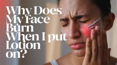 Why Does Avocado Burn My Face?