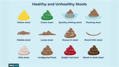 Why Does It Smell Like Poop When I Flush?