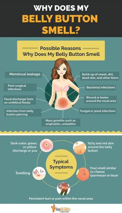 Why Does My Belly Button Smell and Have Discharge?