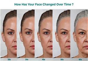 Why Does My Face Start Sagging?
