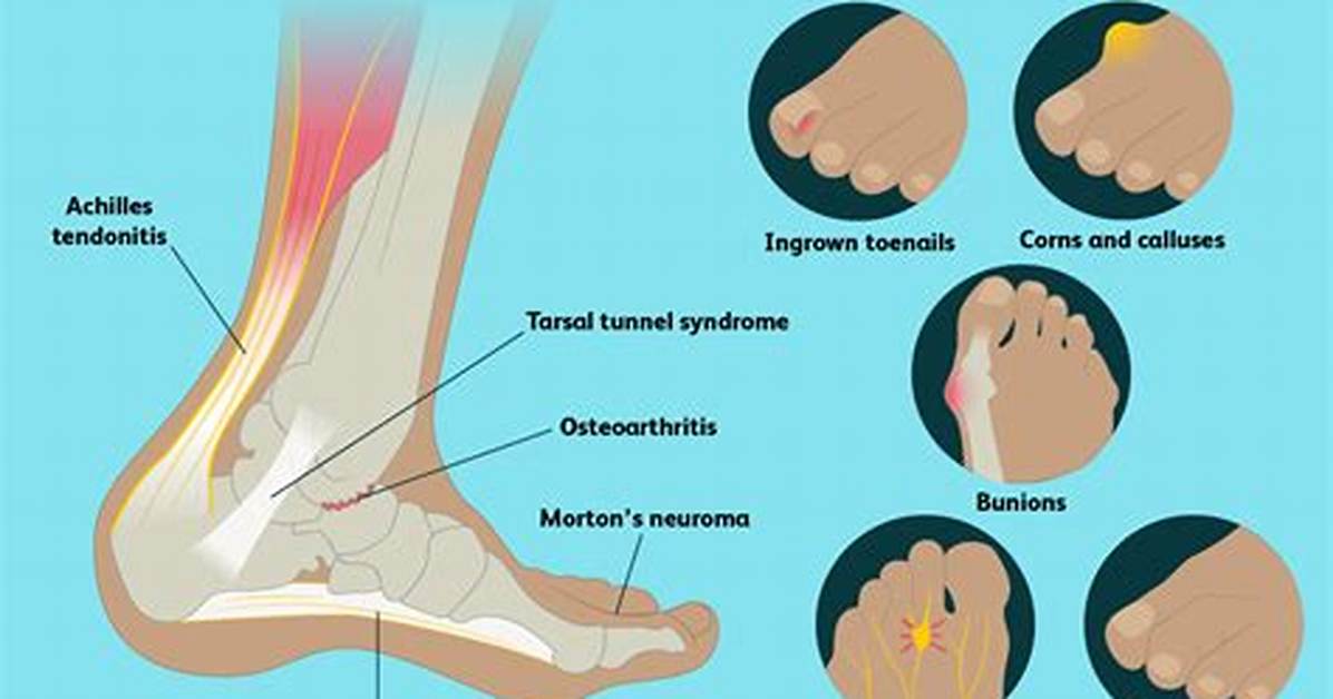 Why Does Surfing Hurt My Feet?