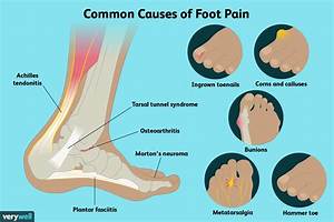 Why Does Surfing Hurt My Feet?