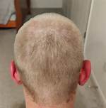 Why Is My Buzzcut Uneven?
