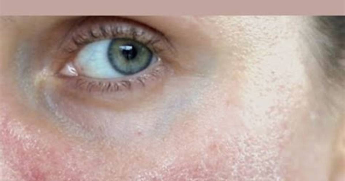 Why Is My Face So White?