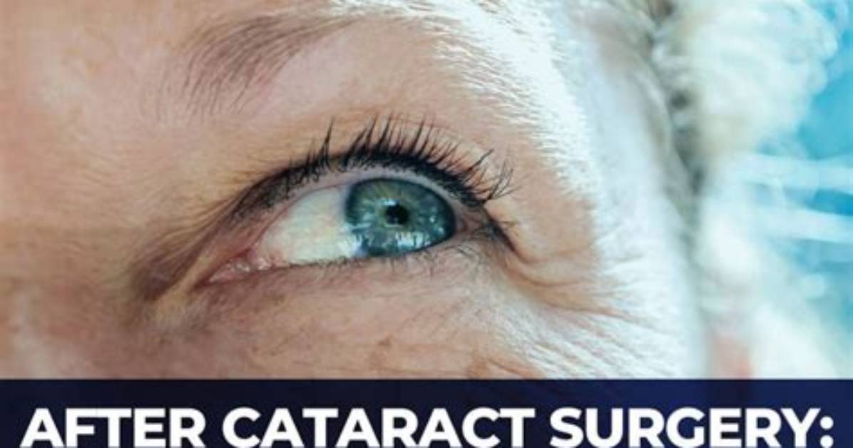Why Is My Face Swollen After Cataract Surgery?