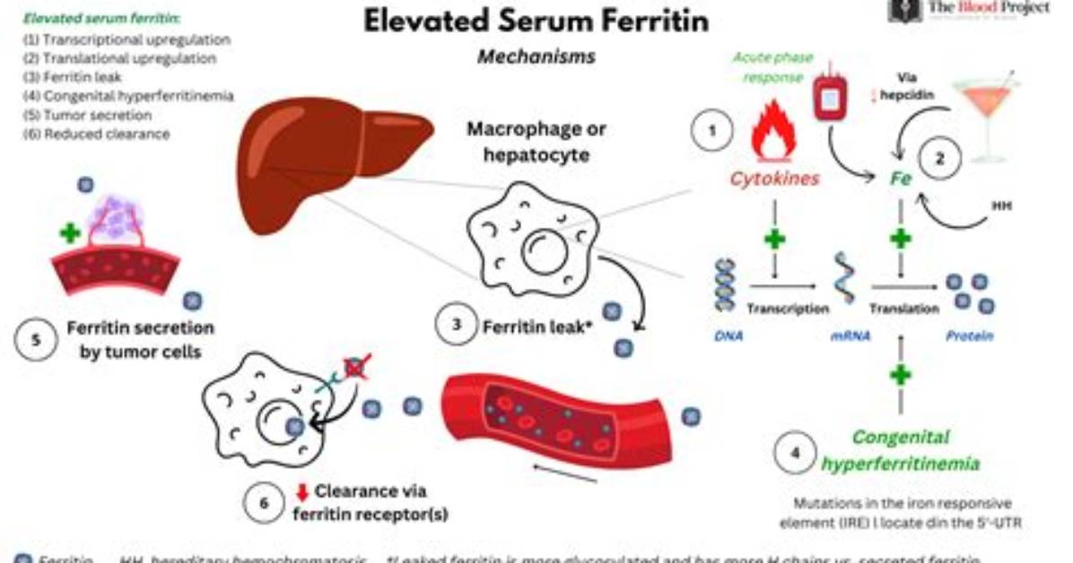 Why Is My Ferritin High but Iron Normal?