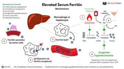 Why Is My Ferritin High but Iron Normal?