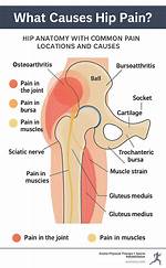 Why Is My Hip Arthritis Pain Worse at Night?