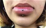 Why Is My Lip Piercing Randomly Swollen?