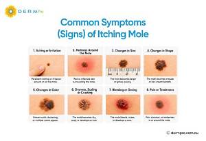 Why Is My Mole Raised and Itchy?