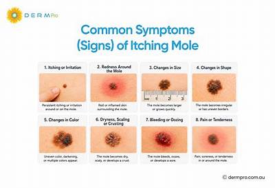 Why Is My Mole Raised and Itchy?